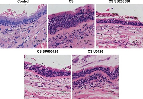 Figure 4 Representative micrography of lung tissue obtained from rats exposed to the CS-induced rat model.