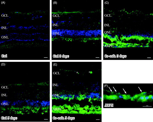 Figure 5. Immunofluorescent staining for complement protein 3 (green) in retinal tissue and ARPE cells; nuclei are counterstained with DAPI. Retinal nuclear layers (ONL, INL, and GCL) are indicated. C3-positive labeling is shown in the ARPE cells (C, E, F) and in the outer retina in co-cultured specimens (C, E). Sparse C3-positive ganglion cells are also seen after 5 days of co-culture (*). C3 labeling in the cultured ARPE cells is cytoplasmic and punctate-like, toward the apical portion of the ARPE cells (indicated by arrows in F). Scale bars, 20 μM.