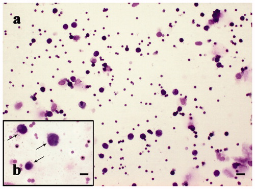 Figure 9. MGG-Quick rapid staining of fluid extract from lugs: (a) lower magnification and (b) higher magnification of extracted cell population; in detail alveolar macrophages (arrows). Scale bars: 50 µm (a) and 10 µm (b).