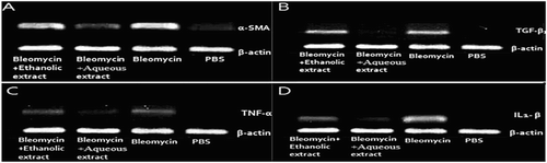 Figure 4. Amplification products were electrophoresed on 2% agarose gel: (A) 21 days after bleomycin instillation, the expression of α-SMA was increased in the lung tissues. However, aqueous extract of licorice reduced the expression of this gene. (B) TGF-β1 expression in the lung tissues receiving aqueous extract decreased compared to the group receiving bleomycin. (C) TNF-α expression in the lung tissues receiving bleomycin increased and the expression of those receiving aqueous extract decreased compared to the group receiving bleomycin. (D) IL-1β expression in the lung tissues receiving aqueous extract was lower than the group receiving bleomycin. PBS (negative control), Bleomycin (positive control), Ethanolic extract (Bleomycin+ethanolic extract of licorice) and Aqueous extract (Bleomycin+aqueous extract of licorice).