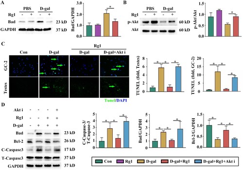 Figure 4. Akt/Bad signaling is responsible for Rg1-mediated protective effects against spermatogonium apoptosis. A Western blots and quantitative results (n = 3). B Representative Western blots and quantitative results (n = 3). C Representative images of TUNEL staining and quantitative results. D Western blots and quantitative results (n = 3). Data are represented as the mean ± S.D. (*P < 0.05; one-way ANOVA).