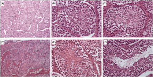 Figure 4. Average growth curves estimated with the Gompertz function during the first 36 weeks for male rabbits exposed to high temperatures during gestation (G+&L−), lactation (G−&L+), both gestation and lactation (G+&L+) and control group (G−&L−).