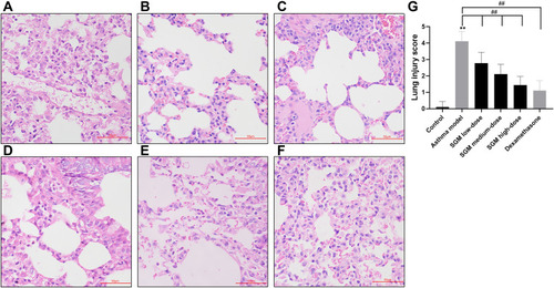 Figure 2 Representative images of hematoxylin and eosin staining in asthma model stimulated with 1% ovalbumin for 6 weeks and with or without SGM administration using ultrasonic spray inhalation for 4 weeks. (A) control group; (B) asthma model group; (C) asthma model with low-dose SGM group; (D) asthma model with medium-dose SGM group; (E) asthma model with high-dose SGM group; (F) asthma model with dexamethasone. (G) Lung injury score. Scale bar 50 μm. Data are mean ± S.E.M. n=8. ** p<0.01 versus control group; ## p<0.01 versus model group.