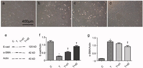 Figure 4. Representative photographs of cell morphology. (a) HK-2 treated with media only; (b) HK-2 treated with TGF-β1 (10 ng/mL); (c) HK-2 treated with TGF-β1 (10 ng/mL) and UA (10 μM); (d) HK-2 treated with TGF-β1 (10 ng/mL) and UA (50 μM). (e) Western blot analysis for E-cadherin and α-SMA. (f, g) Semiquantitative analysis for protein expression of E-cadherin and α-SMA. *p < 0.05 VS. C, †p < 0.05 VS. T. Scale bar = 400 μm.