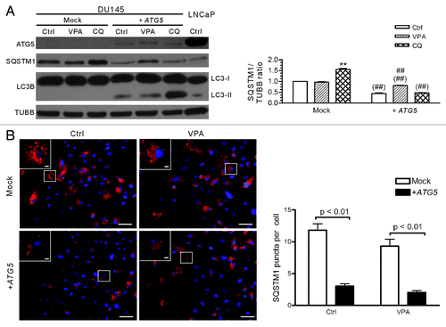 Figure 5. Analysis of SQSTM1 levels and body numbers in mock- or ATG5-transfected DU145 cells. (A) DU145 cells were transfected with mock or ATG5 plasmids, followed by treatment with VPA or chloroquine (CQ) for 24 h and western blot analysis were performed. A sample of LNCaP control cells was included in order to compare the SQSTM1 levels among DU145, LNCaP and PC-3 cells (referred to Fig. 2A). The relative levels of SQSTM1 were normalized to TUBB and the value of mock-treated control was set as 1.0 (right panel). **p < 0.01 vs mock control; ##p < 0.01 vs +ATG5 control; ##p < 0.01 vs the same group of mock. (B) DU145 cells were transfected with mock or ATG5 plasmids, followed by treatment with 3.3 mM VPA for 24 h. The cells were fixed and stained with SQSTM1 antibody, followed by CF568-conjugated second antibody. Fluorescent images were obtained by fluorescence microscopy with a 20× objective lens. Enlarged views of the boxed areas are shown as insets. Scale bar: 50 μm (2 μm in insets). The average numbers of SQSTM1 puncta were scored without prior knowledge of the experimental conditions (right panel). Ctrl, control.