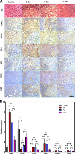 Figure 9 Immunohistochemical staining of the APS/AuNR/PLGA-PEG NPs+ FUS group on day 0, 3, 7, and 14. (A) H&E staining (first row), TUNEL staining (second row), VEGF staining (third row). Immunohistochemical staining of positive expression (brown) of tumor-infiltrating CD3+ (fourth row), CD8+ (fifth row), and lymphoid-infiltrating CD80+ (sixth row), CD86+ (the last row) in the control group: 0 day (left column) and APS/AuNR/PLGA-PEG NPs+ FUS group at 3 days (second column), 7 days (third column) and 14 days (right column). Original magnification, 200×. Bar, 50 μm. (B) Corresponding statistical analysis columns, mean; error bar. *P < 0.05; **P< 0.01; *** P < 0.001; ****P<0.0001. Data were pooled from two independent experiments with five mice per group.Abbreviations: APS, astragalus polysaccharide; AuNRs, gold nanorods; PLGA, poly(lactic-co-glycolic) acid; PEG, polyethylene glycol; NPs, nanoparticles; FUS, focused ultrasound; TUNEL: TdT-mediated dUTP nick-end labeling; H&E, hematoxylin-eosin; VEGF, vascular endothelial growth factor; CD, cluster of differentiation.