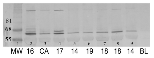 Figure 3 Immunoblot of protein isolated from breast parenchyma from reduction mammoplasty surgical specimens from seven subjects ages 14–19 y (lanes 2, 4–9) and from an invasive breast cancer (lane 3). Lane 1, molecular weight (MW) marker. Ages of subjects indicated below the image. Proteins were isolated, separated under reducing conditions and visualized by immunostaining with an antibody specific for 4HNE lysine adducts as described under Methods. The one prominent immunopositive band identified in all samples corresponds closely in size to that identified in the laboratory of Esterbauer in immunoblots of plasma from children with Systemic Lupus Erythematosus and from atherosclerotic plaques.Citation61,Citation62 In the sample from one 19-y-old subject there is a second prominent immunopositive band of a slightly higher MW. The only distinguishing immunocytochemical feature of sections from this subject was the presence of an unusually large number of growing ducts with immunopositive termini. The variable amount of 4HNE+ and 4HNE− adducts in cells in the mammary epithelium and stroma contributing to the 50 µg protein loaded onto the gels, and the difficulty of extracting proteins from the collagenous stroma, precluded being able to correlate the intensity of the protein bands with extent of immunostaining in tissue sections.