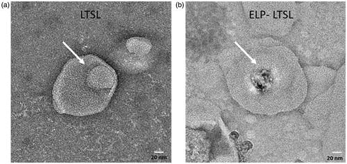 Figure 3. TEM images of LTSL and ELP-TSL (DPPC:DSPC: Cholesterol: 75:25:15 molar ratio) loaded with cipro. Crystallized cipro is seen within the core of the liposomes (arrows).