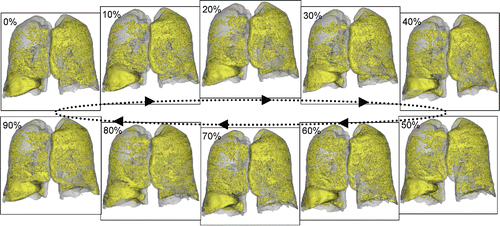 Figure 3. Segmentation results and visualization of the whole lung and the emphysematous areas (in yellow) during the whole respiratory cycle (from 0% to 90%). The lung volume in detail was: 0% – 5889 ml, 10% – 5777 ml, 20% – 5714 ml, 30% – 5754 ml, 40% – 5980 ml, 50% – 6251 ml, 60% – 6359 ml, 70% – 6313 ml, 80% – 6079 ml, 90% – 5963 ml. The emphysema index in detail was: 0% – 20.2%, 10% – 20.1%, 20% – 20.0%, 30% – 20.2%, 40% – 21.1%, 50% – 22.3%, 60% – 22.8%, 70% – 22.6%, 80% – 22.1%, 90% – 21.5%.