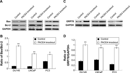 Figure 7 Observation of apoptosis in PACE4 gene knockdown prostate cancer cell lines.