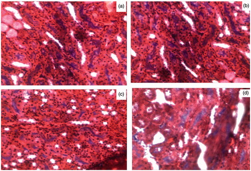 Figure 6. Masson trichrome staining of kidney tissue: (a) Control; (b) Diabetes; (c) Diabetes + MRS1754; (d) Control MRS1754. All images are representative glomeruli at an original magnification of 400×.