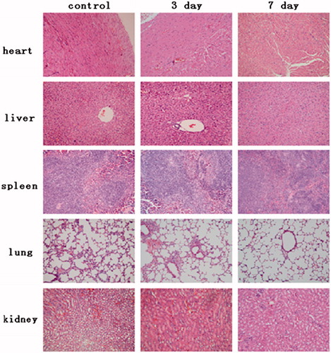 Figure 7. Photogragh of major organs after oral administration of UC treatment of mice (40×). Mice cardiac muscle, liver, spleen, lung and kidneys’ photogragh of control group and P(CE-MAA-MEG) hydrogel treated group, respectively.