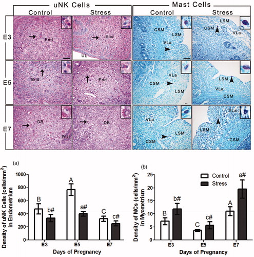 Figure 3. Photomicrographs show the effects of restraint stress on the distribution and density of uNK cells and mast cells in the uteri of pregnant mice on E3, E5, and E7. The morphology of uNK cells in the endometrium and mast cells in the myometrium was examined by staining with PAS and toluidine blue, respectively. Long arrows indicate positive-staining uNK cells in the endometrium, and short arrows indicate positive-staining mast cells in the myometrium. Scale bars = 50 μm. The density of uNK cells (a) in the endometrium and mast cells (b) in the myometrium are shown. Data (cells/mm2) were expressed as the mean ± SD. The meaning of the letters in the bar chart is the same as Figure 1. #p < 0.01 were used to denote significance compared with the corresponding control groups. uNK cells, uterine natural killer cells; MCs, mast cells; End, endometrium; UL, uterine lumen; DB, decidua basalis; RUL, residual uterine lumen; LSM, outer longitudinal smooth muscle of uterine wall; CSM, inner circular smooth muscle of uterine wall; Ug, uterine gland; VLa, vascular layer.