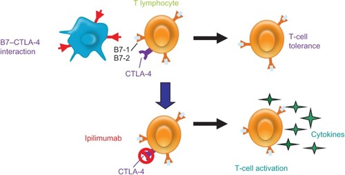 Figure 1 CTLA-4 pathway is a key regulator of T-cell activation and tolerance. CTLA-4 is a negative regulator that is expressed on the surface of T-lymphocytes and suppresses the immune system. Blocking CTLA-4 with ipilimumab, an anti-CTLA-4 antibody, allows for an antitumor response.Abbreviation: CTLA-4, Cytotoxic T-Lymphocyte Antigen 4.