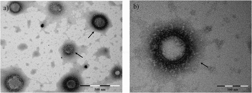 Figure 1. EV-like structures (range: 80–200 nm) released in culture media by Ascaris suum adult worms after three days incubation, visualized by TEM. Scale bar is indicated in the figure. EVs are purified by ultracentrifugation.