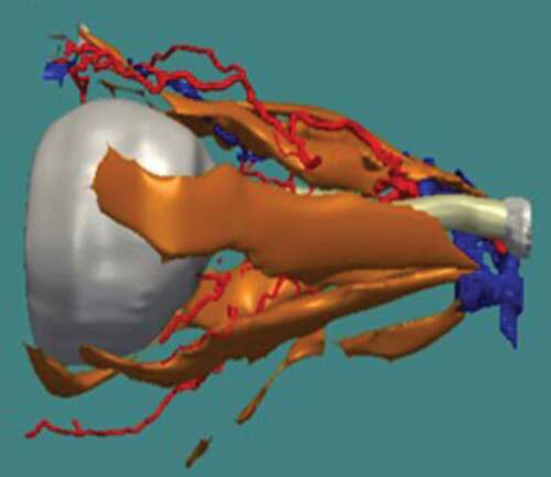 Figure 5. Arterial and venous system of the orbit in relation to the optic nerve (white) and extraocular muscles (gold)