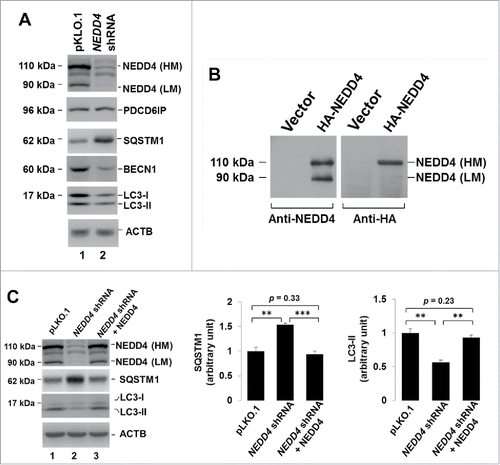 Figure 3. Knockdown of NEDD4 reduced LC3 protein levels and increased SQSTM1 protein levels. (A) The effect of NEDD4 knockdown on autophagic protein levels in lung cancer A549 cells. (B) The low molecular weight NEDD4 (NEDD4 [LM]) is a degradation product of full-length NEDD4 (NEDD4 [HM]). The HA-tagged NEDD4 was ectopically expressed in HEK293 cells and detected by immunoblotting with either anti-NEDD4 (the left panel) or anti-HA (the right panel). (C) Re-expression of NEDD4 in the NEDD4 shRNA cell line rescued the protein level of LC3 and SQSTM1. **P<0.01; ***P<0.001.