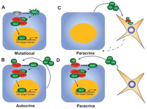 Figure 2 Modes of Hh pathway signaling. (A) Type I Hh signaling is activated by specific mutations within pathway genes within tumor cells, resulting in ligand-independent constitutive activation. (B) Type II Hh signaling results from autocrine signaling from tumor cell to tumor cell. (C) Type IIIa activation results from secretion of Hh ligand by tumor cells, resulting in pathway activation in surrounding tumor stroma. (D) Type IIIb Hh signaling results from Hh ligand secretion by tumor stroma, resulting in activation of the pathway within tumor cells themselves.