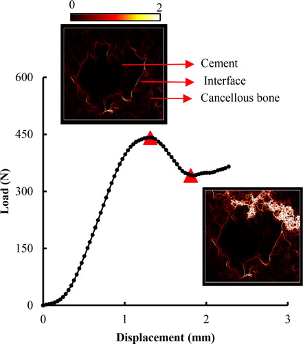 Figure 1. Load displacement curve for the sample with balloon inflation, highlighting the crack initiation and final fracture (marked red symbols) with equivalent strain.