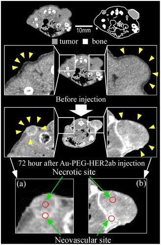 Figure 9. Contrast effect within a tumor after the injection of 15-nm Au-PEG nanoparticles. The Au-PEG nanoparticles enabled us to image a microtumor that was only a few millimeters in size in mice, while 30-nm Au-PEG did not. The right and left images show large tumors and microtumors, respectively. Yellow arrowheads demonstrate the tumor region. The CT values of the ROIs (red circles) were measured. The CT values of the necrotic and neovascular sites in (a) were 72 ± 14 HU and 244 ± 33 HU, respectively. The CT values of the necrotic and neovascular sites in (b) were 60 ± 15 HU and 280 ± 45 HU, respectively.