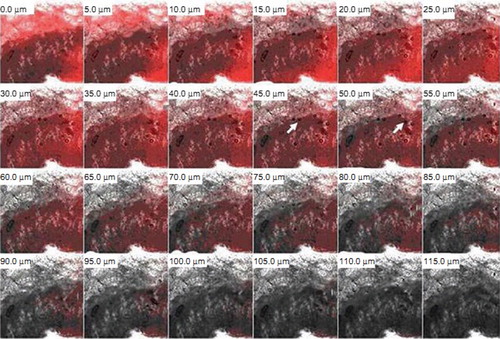 Figure 4. Confocal microscopic images of oleic acid vesicle in rat skin.