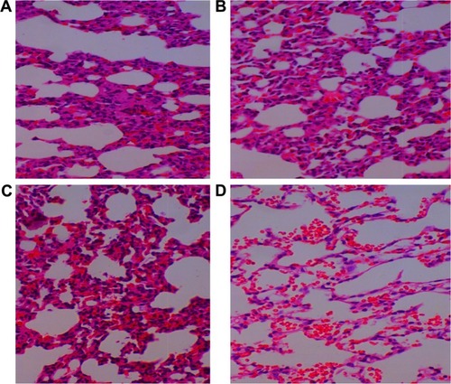 Figure 5 The pathological sections of lung at 1 (A), 4 (B), and 7 days (C) after intravenous administration of baicalin-loaded nanoliposomes and saline (D) as the control. Magnification ×200.