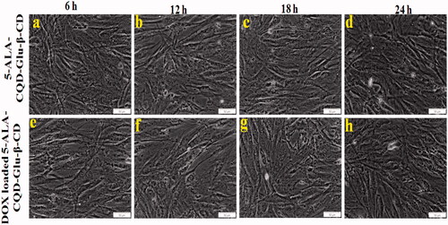 Figure 8. In vitro morphological changes of fibroblast (WS-1) cell line treated with 5-ALA CQD-Glu-β-CD and DOX/5-ALA-CQD-Glu-β-CD nanocarrier in a various time-dependent manner such as 6 h, 12 h, 18 h, and 24 h and IC50 concentration of 60 μg/mL at scale bar: ∼50 μm.