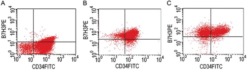 Figure 3. B7-H3 and CD34 coexpression patterns. Cells from AL cases were double-stained with anti-B7-H3-PE (y-axis) and anti-CD34-FITC (x-axis) mAbs and analysed by flow cytometry. Each dot-plot shows a representative pattern for B7-H3/CD34 expression. B7-H3 almost exclusively expressed on CD34-positive cells and most AL cases were of a weak positive expression as shown in (A). High expressions of B7-H3 (B) and the expression on CD34− cells (C) were individual.