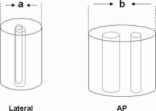 Figure 1. Cast index (a/b) at fracture site. Internal cast width on lateral radiograph (a) and internal cast width on AP radiograph (b).