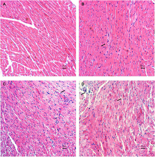 Figure 1 HE staining of heart tissue 1 month after irradiation and/or PD-1 inhibitors treatment in each group. “↑” shows cardiac structural impairments and/or lymphocyte aggregation. (A) Control; (B) PD-1 inhibitors; (C) Irradiation; (D) PD-1 inhibitors + irradiation.