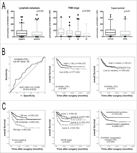 Figure 2. Analysis of the S100A8+TIF, S100A8+TC, TB, and SATB index. (A) The S100A8+TIF cell counts were less in the lymph node metastasis groups than that in the non-lymph node metastasis groups (left); the S100A8+TIF cell counts were less in the higher TNM stage (middle) groups; the S100A8+TIF cell counts were more in 5-y alive groups than that in death groups (right); p value was calculated by unpaired t test. (B) ROC curve analysis of the S100A8+TIF (left), and the Kaplan–Meier survival analysis (log-rank test) of the S100A8+TIF (middle) and the S100A8+TC (right). (C) TB grade (left) and SATB index defined by the S100A8+TIF and TB grade (middle) predicted overall survival by the Kaplan–Meier survival analysis (log-rank test); the density of S100A8+ cell-marginated vessels in the TC was favorable for overall survival (right); n = total cases (death cases).