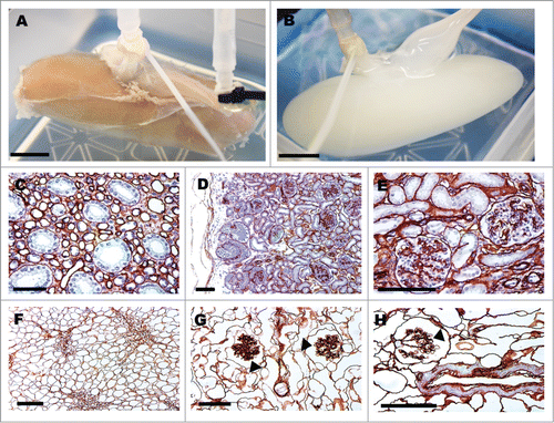 Figure 1. Pig kidneys pre- and post-decellularization and collagen-IV staining of glomerular structures. Gross image of pig kidney pre- (A) and post-decellularization (B), scale bar 1 cm. Collagen-IV immunohistochemical staining of basement membranes (C–H). Pig kidney histology before decellularization (C–E) and after (F–H); arrow heads point to acellular glomerular vascular tufts (G,H). Scale bar (C–H) 100 μm.