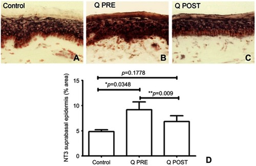 Figure 7 Immunohistochemistry in skin biopsies for NT3, before and after capsaicin 8% patch treatment. NT3 immunostaining from (A) control subjects, and CIPN patients before (B, Q PRE) and after capsaicin 8% patch treatment (C, Q POST). (D) Bar chart showing NT3 suprabasal image analysis (% area).