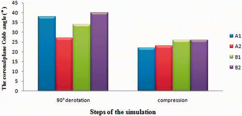 Figure 3. The coronal plane Cobb angle of scoliosis after applying the four different solutions. After compression, the four solutions yielded almost identical results for the final scoliosis correction of deformity in the coronal plane.