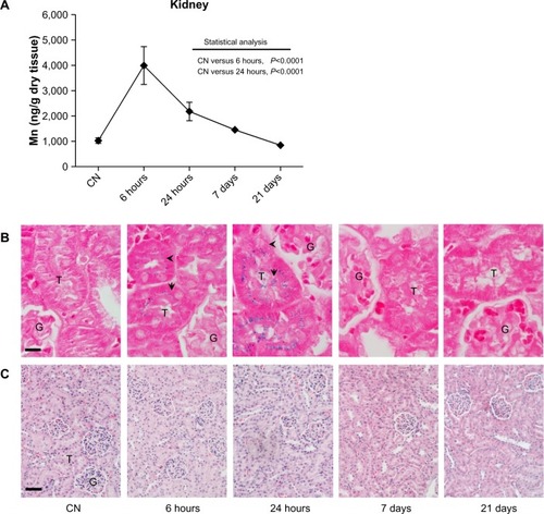 Figure 4 (A–C) Quantitative determination of nanoparticles in the kidney and histological evaluation. (A) Time-dependent changes in Mn concentrations in kidney after the ferrofluid intravenous injection. Data are presented as means ± standard error of mean (n=6). (B) Prussian blue staining of kidney sections shows the presence of iron (arrow and arrowhead) exclusively at shorter experimental times. Translocation of iron from cortical (6 hours) to medullary (24 hours) tubules suggests a rapid renal clearance of injected nanoparticles; bar 10 μm. (C) Images of kidney sections stained with hematoxylin and eosin showing no relevant change in cellular and tissue architecture; bar 50 μm.Abbreviations: G, glomerulus; T, tubule; CN, vehicle-treated mice.