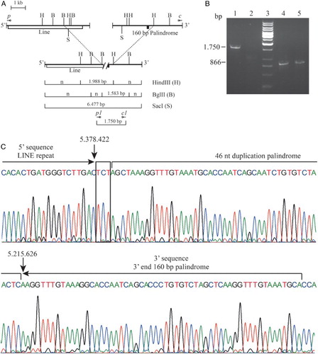 Figure 2. Molecular characterization of the Italian (ϵγδβ)0-thalassemia. (A) Long-range PCR fragment obtained using the qRT-PCR primers p and c. In the upper part of the normal cluster in the lower line the recombinant cluster. Restriction mapping of the enzymes HindIII, BglII, and SacI are reported. The vertical dashed lines connect the same restriction sites. The length of the anomalous fragments is reported. The position of the primers are indicated with the symbol *; n indicated fragment of normal length. (B) Gap-PCR for the screening of carriers for the Italian (ϵγδβ)0-thalassemia. Lines 1–2: Gap-PCR for the Italian (ϵγδβ)0-thalassemia (1.750 bp); Lines 4–5: PCR for the internal control amplicon (867 bp). Lanes 1 and 4: proband; lanes 2 and 5: normal controls; lane 3: reagent control. (C) Electropherogram of the sequence of the Italian (ϵγδβ)0-thalassemia deletion breakpoint. The LINE sequence in the 5′ and the 160-bp palindrome in the 3′ breakpoint are reported; the microhomology found is in a box. Deletion breakpoints are highlighted with arrows. The nucleotide numbering of the normal sequences, according to reference sequence GRCh37/hg19, is shown.
