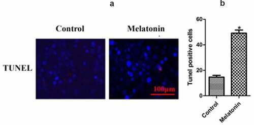 Figure 6. The results of TUNEL staining in the two groups of LC cells. Control: the blank control group; Melatonin: the melatonin group. (a): TUNEL results. (b): bar graphs with errors bars. *Compared with the control group, there existed a statistical significance, P < 0.05.