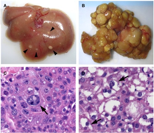 Figure 3 Hepatocellular carcinoma development following YAP induction in a transgenic murine model.