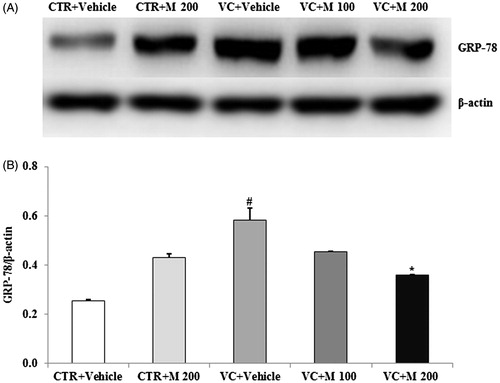 Figure 3. Effects of MOTILIPERM on levels of GRP-78 protein in the varicocele-induced endoplasmic reticulum stress response. (A) Western blot of testis. (B) Level of GRP-78 protein for each group. Beta-actin used as a loading control to normalize the GRP-78 protein levels in each sample. GRP-78: glucose-regulated protein-78; CTR + vehicle: normal control group; CTR + M 200: normal rats administered 200 mg/kg MOTILIPERM; VC + vehicle: varicocele-induced rats; VC + M 100: varicocele-induced rats administered 100 mg/kg MOTILIPERM; VC + M 200: varicocele-induced rats administered 200 mg/kg MOTILIPERM. #Significantly different from CTR + vehicle group (p < 0.05). *Significantly different from VC + vehicle group (p < 0.05).
