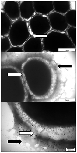 Figure 10 Interaction between Candida albicans and platinum nanoparticles. Black arrows indicate nanoparticles surrounded by the released substance. White arrows indicate the cell wall loosened and separated from the membrane or disrupted.
