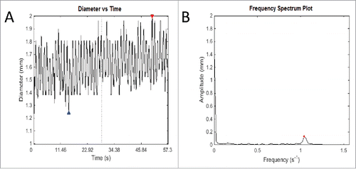 FIGURE 4. An example of the output of Fast Fourier Transform. (A) This graph records fluctuations in diameter of a transverse slice of intestine over time. The red and blue arrows represent the highest and lowest diameter respectively of that particular video analysis. Owing to the intrinsic width of the intestine, fluctuations cannot be about the zero mark, but rather around the length-dependent variable diameter of the intestine. (B) The frequency spectrum plot shows the most salient frequency – that is, the frequency with the highest amplitude, to choose the predominant frequency and amplitude. This allows elimination of other signals that contribute to ‘noise’ in the graph of diameter change over time, which ideally should be sinusoidal in shape. This method is used to eliminate human error in counting the number of contractions over time and using an average, which is used currently in the literature. As well as this, it allows more detailed information about the amplitude of contractions, which is difficult to measure, and as yet has not been studied in detail in gastrointestinal motility experiments in the literature.