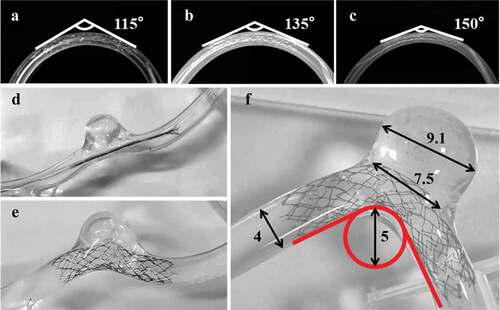 Figure 7. Stent deployment process: 3 mm inner diameter bent silicone tube with a centerline radius of (a) 4 mm, (b) 5 mm, (c) 6 mm and (d-f) aneurysm silicone vessel model with inner diameter of 4 mm.