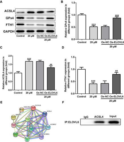 Figure 5 ELOVL6 overexpression restores the regulatory effects of apatinib on the expression of ferroptosis-associated proteins via ACSL4. (A–D) The expression of ACSL4, GPx4 and FTH1 was determined using Western blot analysis. ***P<0.001 vs control; ##P<0.01, ###P<0.001 vs Oe-NC. (E) The protein–protein interaction network for ELOVL6. (F) Immunoprecipitation was performed with indicated antibodies in HCT116 cells. The immunocomplexes were subjected to Western blot assay.