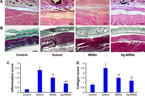 Figure 6 In vivo wound healing performance of nano-adhesives.Notes: Representative (A) H&E staining and (B) Masson’s trichrome staining images of normal skin treated with ethicon suture, MSNs and Ag-MSNs at day 5 post-wounding. The scale bars represent 200 and 500 µm for (A and B), respectively. The stars indicate inflammatory cells. (C) Inflammatory responses of the wound area according to the pathology criteria (score 0–3). (D) Levels of collagen formed at the wound area were measured according to the pathology criteria (score 0–3). The values represent mean values±SD, n=6. *P<0.05 vs control group, #P<0.05 vs suture group, &P<0.05 vs MSNs group.Abbreviations: Ag-MSNs, nanosilver-decorated mesoporous silica nanoparticles; MSNs, mesoporous silica nanoparticles.