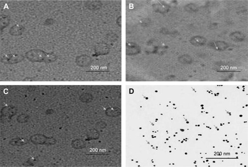 Figure 1 Transmission electron photomicrographs of flucytosine, gold-loaded liposomes, and gold nanoparticles according to the prepared formulations.