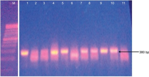 Figure 3 Detection of 380 bp AmpC fox gene by PCR among the Salmonella isolates.Notes: Lane M = 100 bp ladder; lanes 1–3 = Salmonella typhimurium; lanes 4–7 = Salmonella typhi; lanes 8 and 9 = Salmonella enteritidis; lane 10 = Salmonella choleraesuis; lane 11 = Salmonella paratyphi.Abbreviation: PCR, polymerase chain reaction.