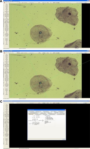 Figure 1 (A, B) Histologic views of exfoliative cell samples. (C) Stereological formulas.