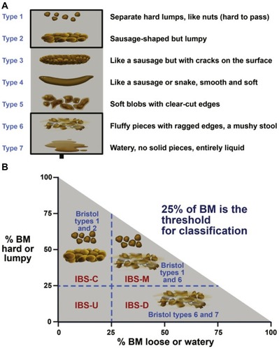 Figure 1 (A) The Bristol Stool Form Scale (BSFS) is a useful tool to evaluate bowel habit. The BSFS has been shown to be a reliable surrogate marker for colonic transit. (B) IBS subtypes should be established according to stool consistency, using the BSFS. IBS subtyping is more accurate when patients have at least 4 days of abnormal bowel habits per month. Bowel habit subtypes should be based on BSFS for days with abnormal bowel habits. Reprinted from Gastroenterology, 150(6), Lacy BE, Mearin F, Chang L, et al,  Bowel disorders, 1393, copyright (2016), with permission from Elsevier.Citation8 