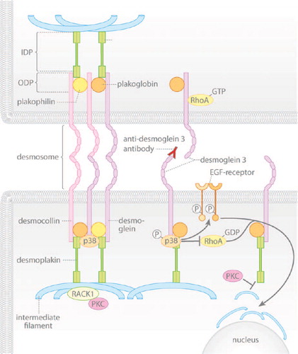 Figure 1. The signaling mechanisms triggered by pemphigus autoantibodies reduce the cytoskeletal anchorage of desmosomes. Under resting conditions, desmogleins and desmocollins in desmosomes are linked to intermediate filaments via desmoplakin and the adaptor proteins plakoglobin and plakophilin. Desmosomal components interact with several signaling molecules: p38MAPK is associated with Dsg3, PKC is sequestered by keratin filaments via RACK1 and active RhoA is bound to extradesmosomal Dsg3. Upon autoantibody binding, p38MAPK is activated within the signaling complex with Dsg3, a process involved in EGF-R activation and RhoA inhibition, which finally causes keratin retraction. In parallel, PKC activation reduces intermediate filament binding to desmoplakin.