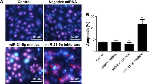 Figure 7 The apoptosis of SGC-7901 regulated by the over-expression of miR-21-5p analyzed by Hoechst 33258 staining and fluorescence microscope.